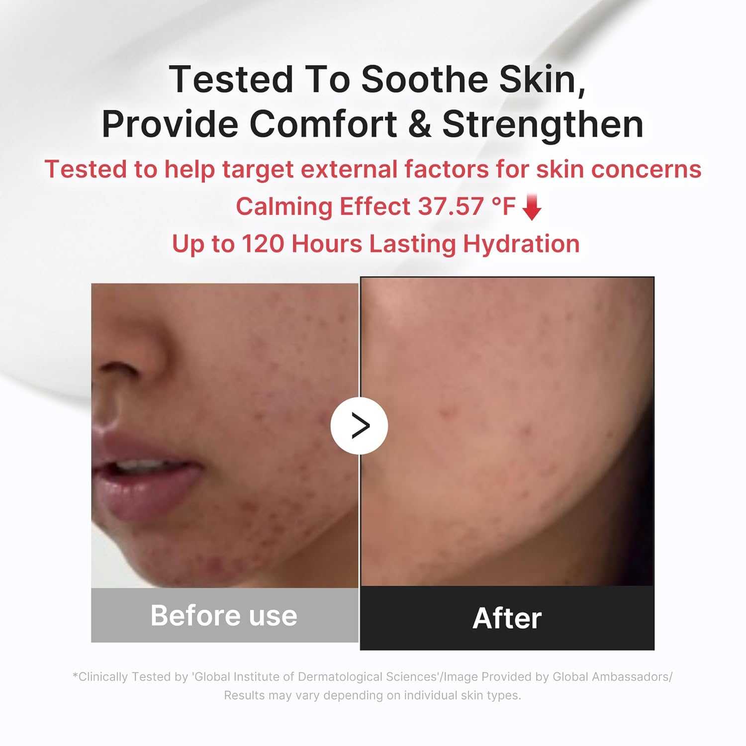 medicube 3H Daily Relief Cream | Daily Soothing Moisturizer for All Skin Types | Lightweight Comforting Cream Ideal For Use After Spot Care | Guaiazulene, Centella, Ceramide for Balance and Hydration